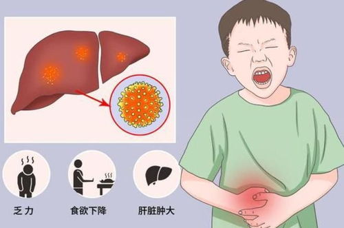 儿童乙肝大部分可完全治愈 及早治疗是关键