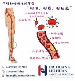 小腿溃烂 下肢动脉狭窄