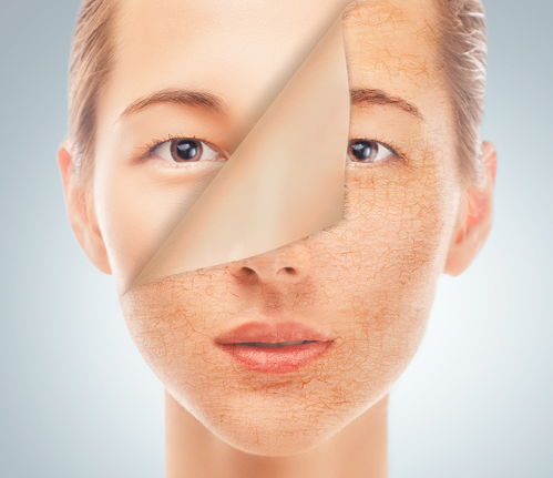 皮肤太干如何补水 改善干性皮肤的六项建议