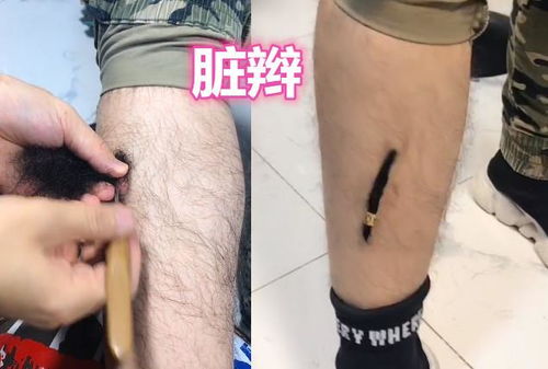 男生对 腿毛 下手了 锡纸烫忍住了,看到染色 脸都绿了