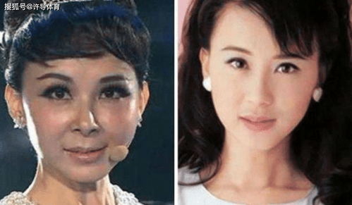 整容失败的7位女星,每一个都成了 反面教材 ,自己作死怪谁呢