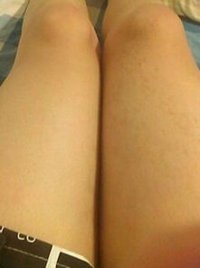 大腿右边有点比胎记颜色淡很多的不知道是什么就是觉得不好看有点恶心 