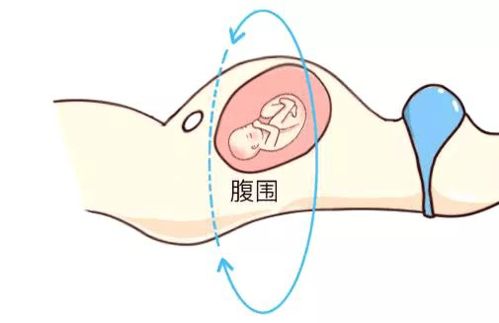 孕期产检的宫高腹围是什么