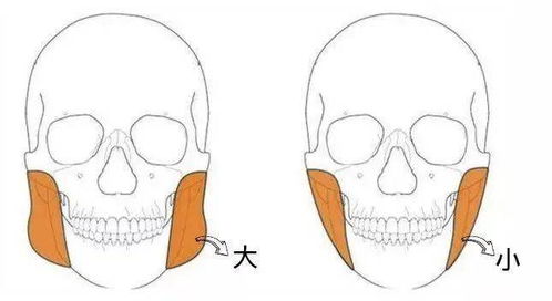 人不胖,脸胖是怎么回事 几个 瘦脸小技巧 ,拯救大家的脸大烦恼