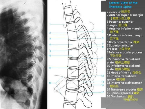 超详细的腰椎X线解剖及解读