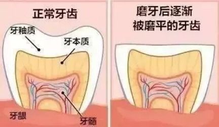 孩子夜间磨牙,是因为缺钙或肚子里有蛔虫吗