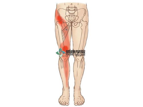 大腿內側疼痛是什么原因,大腿內側肌肉疼痛是怎么回事？