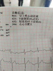 为什么前年学校体检我量170CM，今天我早上在自己家量只有169?