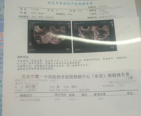 月经来前降温却怀孕了 月经推迟3个月还没来 月经正常却怀孕4月了 蓝天微生活 