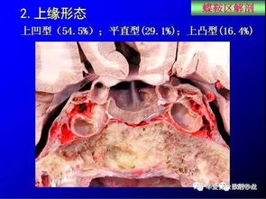 这么全的鞍区影像解剖,赶紧收藏备用 