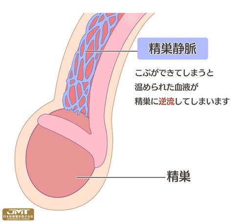 JMT日本医疗 一文解析不孕症男女双方的主要原因和检查方法分别是什么