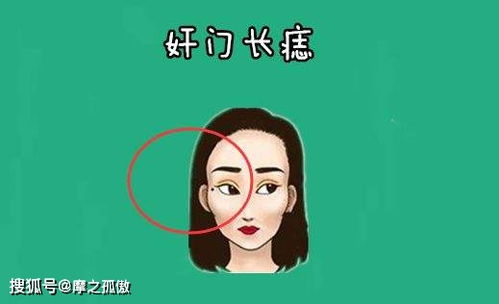 女人四个最不好的痣,都有什么影响