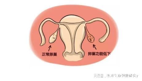 卵巢储备功能减退主要原因有哪些?试管助孕能不能怀上？