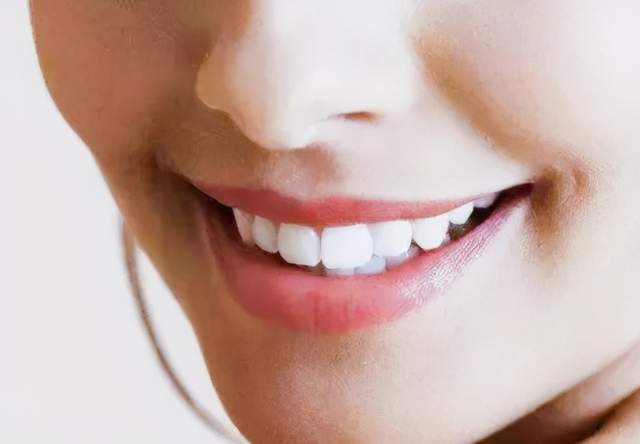 美牙贴面当下正流行,问题来了 牙贴面的使用寿命能维持多久呢