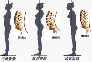 脊椎怎样影响我们的健康 你一定要知道