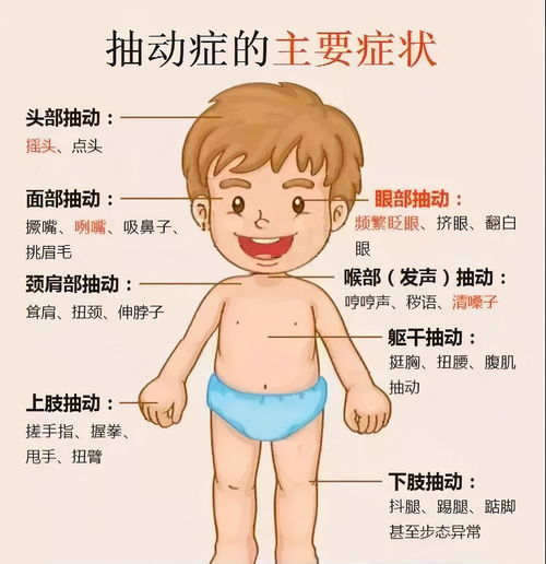 挤眉弄眼 摇头耸肩 孩子行为怪异,当心被抽动症 盯 上