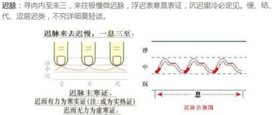 普通人都能学会的中医基础,看图学把脉吧 