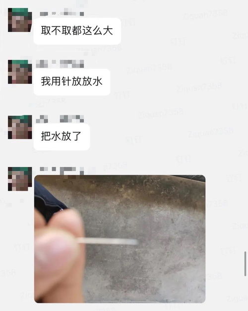 淘宝买自助 割包皮 工具包, 命根子 表示我怕是要废了