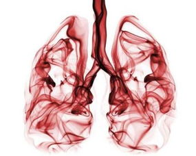 湖南每4个新发癌症患者,就有1个肺癌,肺癌高危因素有哪些