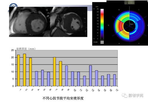 cmr(LSZH和CMR各是什么意思？)