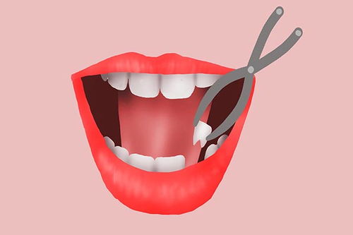 牙齿问题对孕妇有哪些危害 尽早保护牙齿健康,宝宝茁壮成长