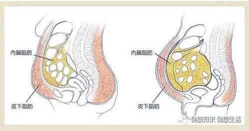 内脏脂肪要怎么减