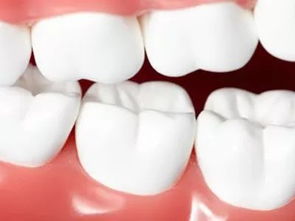 什么食物能让牙齿变白 强烈推荐5种食物给你