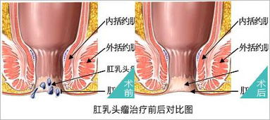 养花列题纲