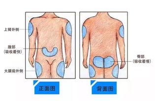 三分钟带你快速揭开胰岛素的面纱 内附胰岛素笔使用视频 