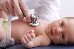 小儿黄疸测出来有28,宝宝出生四天，黄疸达到28