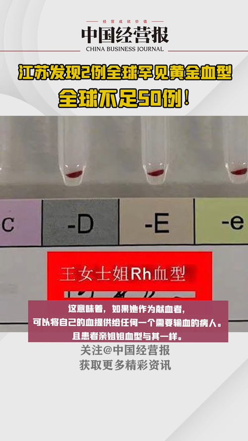 江苏发现2例全球罕见黄金血型,该血型自1960年发现以后全球不足50例 