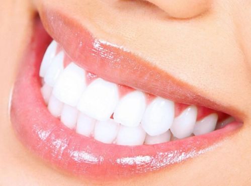 如何让黄牙变白 牙齿美白方法小妙招大全 