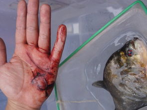 广西柳州食人鱼突袭2人 伤者手掌血肉模糊