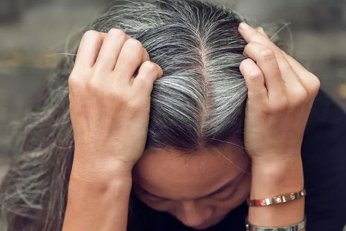 女性白头发日渐增多,别总以为自己老了,或许是因为缺乏4种营养