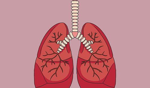 肺部有病,喉咙先知 喉咙出现哪些变化,需要去做检查