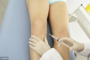 膝关节骨关节炎治疗时可关节内注射药物有哪些(膝盖骨关节炎打针)