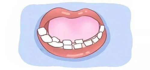 乳牙滞留多久一定要拔 如何预防