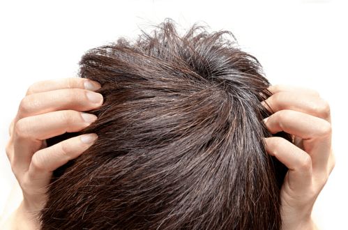 警惕 长白发可能预示健康问题