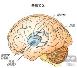 专家教你 快速学会脑出血部位辨识