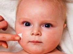 婴儿湿疹的护理