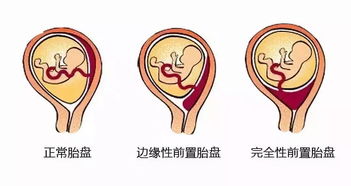 胎盘是滋养胎儿生命的源泉