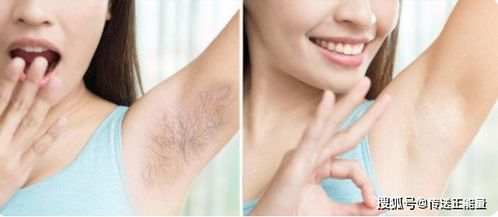 为什么有的女性体毛旺盛,有的 光秃秃 哪类人更健康