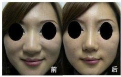 鼻头缩小化妆法(怎么缩小鼻翼和鼻头化妆)