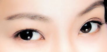 广州博美整形医院 双眼皮术后护理有哪些