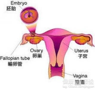 宫外孕怎样处理