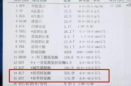 转氨酶高是怎么回事有什么危害