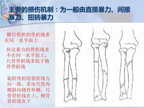 尺骨桡骨解剖图 搜狗图片搜索