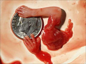 4个月流产胎儿图片图片