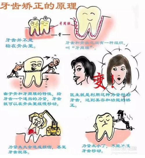 牙齿矫正的科学原理 