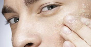 角质一般多少时间做一次 脸部保养 脸部清洁多久做一次 